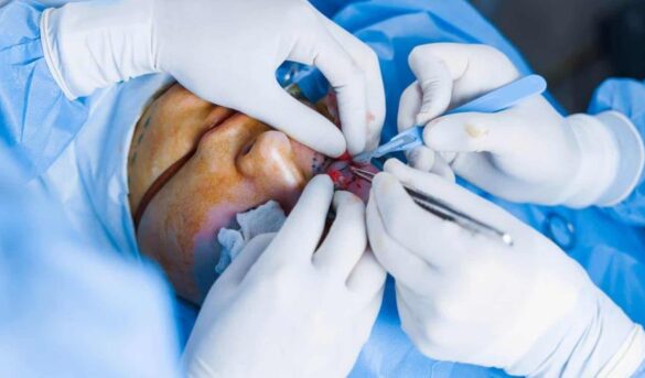 Turistas que visitan a República Dominicana por salud gastan hasta US$9,000 en promedio